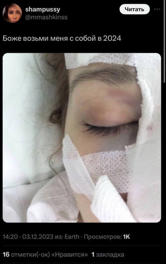 Девушка из «Твиттера» рассказала об ужасной аварии и попросила денег на лечение.