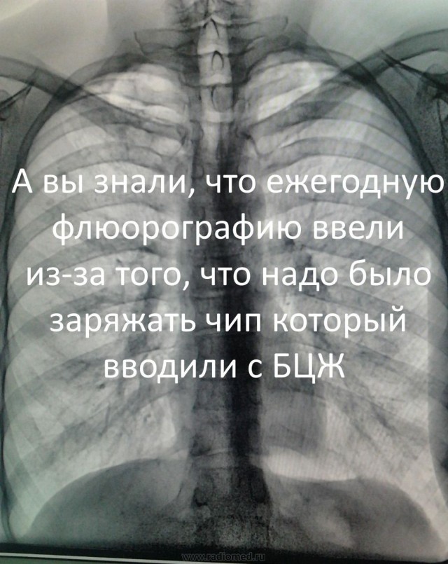 Про чипирование