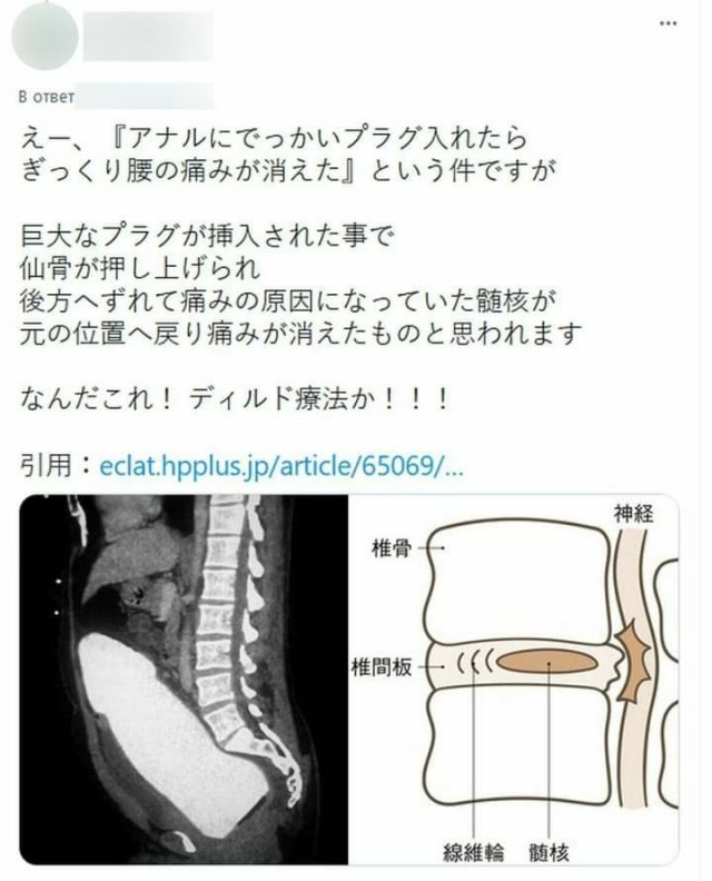 Когда метод решения проблемы "через *опу" сработал