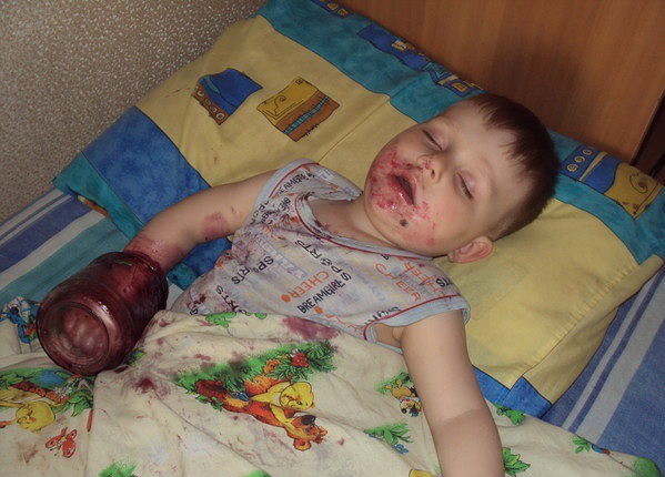 Передозировка