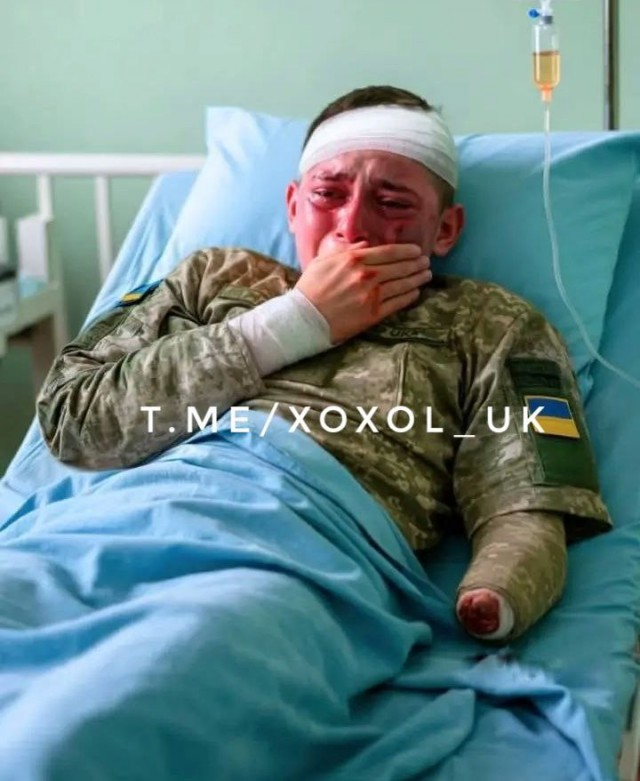 "Я не потерял ноги, а отдал за Родину!"