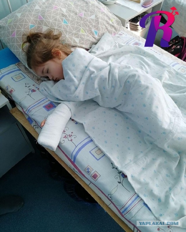 В Тольятти ребенку ампутировали палец после травмы в детском саду