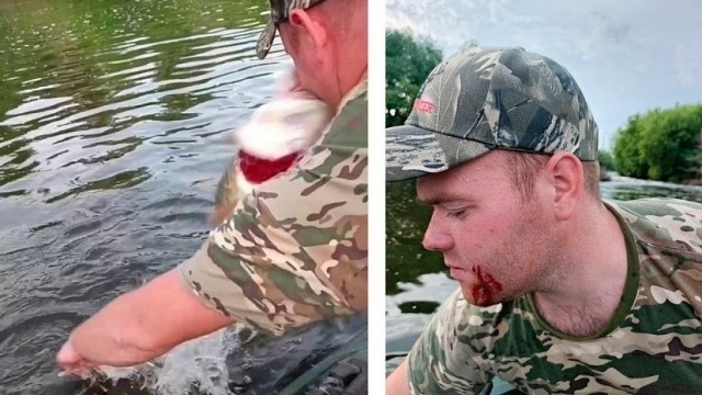 Нет,но это просто беспредел какой то. Пойманная щука накинулась на рыбака и укусила его в лицо.