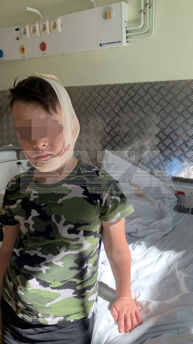 Полицейский на электросамокате сбил 8-летнего мальчика в Петербурге. Теперь ребёнку предстоит операция