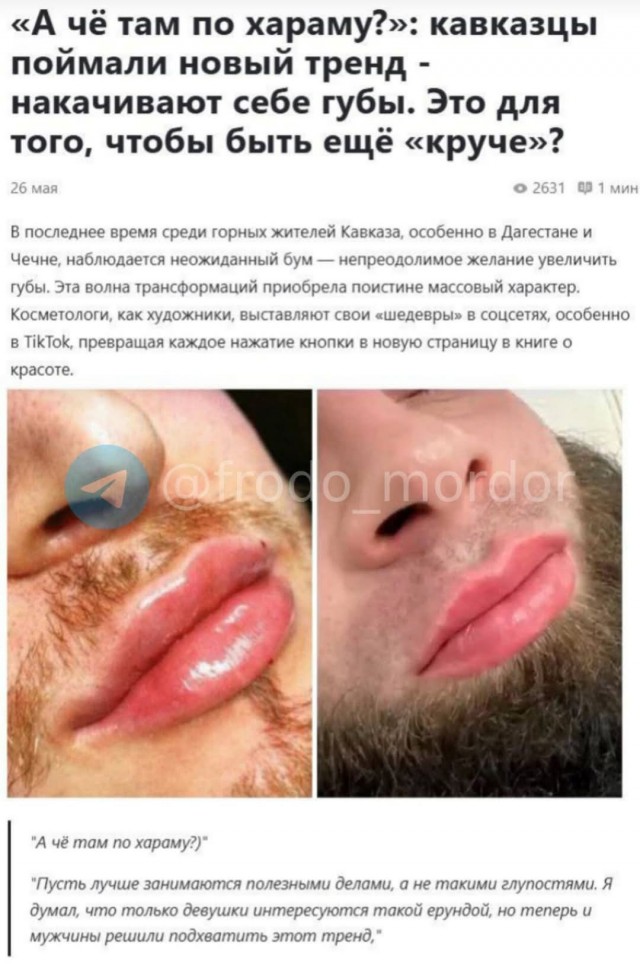 Псто