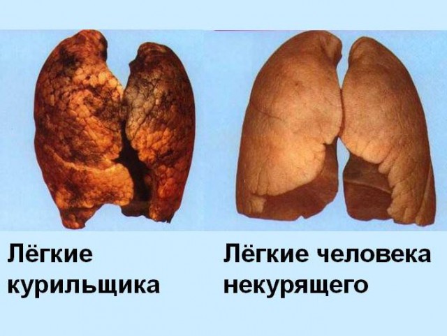 Эффекты курения на примере близнецов