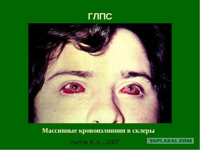 Японская мышеловка