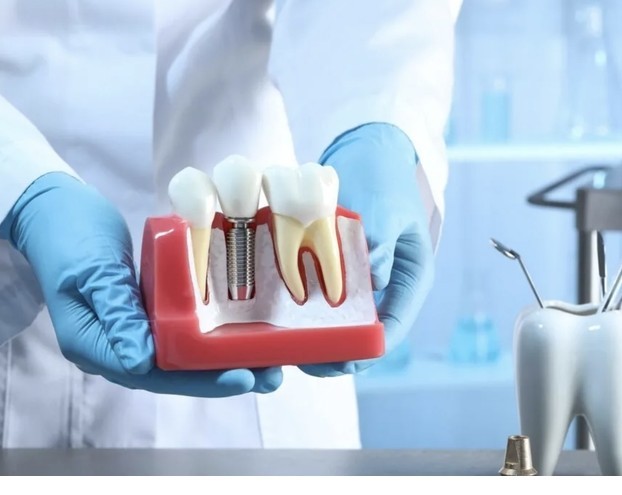 Немного про импланты.