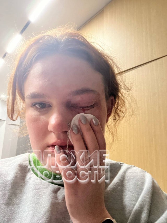 В Екатеринбурге парень из Ирака избил русскую девушку, которая решила прекратить с ним отношения