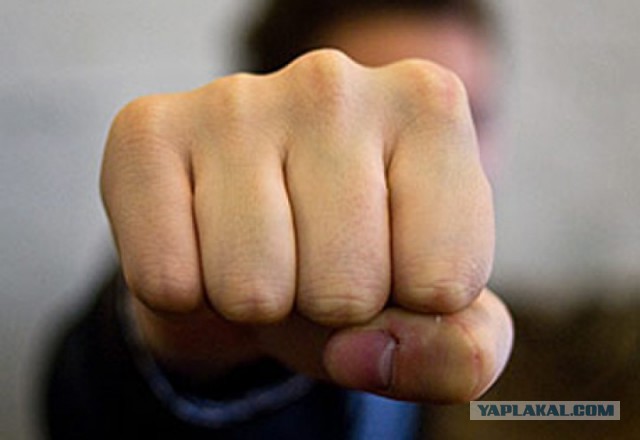 19-летняя россиянка увеличила губы с помощью пылесоса