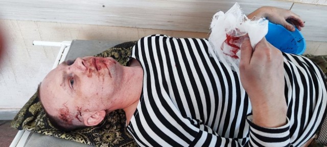 В Саратовской области избили участника боевых действий в Сирии и на Донбассе после урока мужества