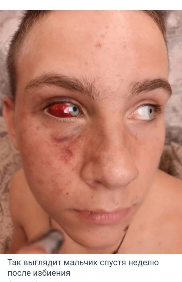 В Волгограде возбудили уголовное дело на избивших подростка полицейских