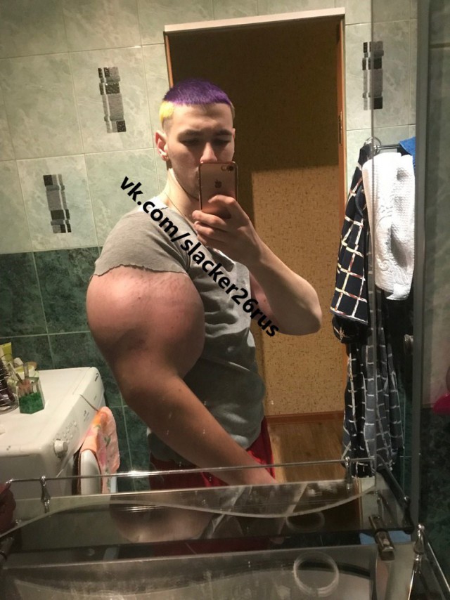 Принц синтола