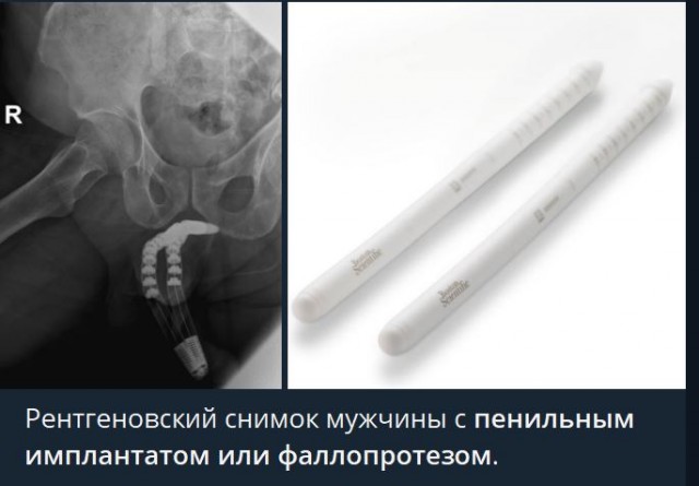 Победная поступь идиотизма по планете – том 6