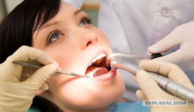 Пломбирование зубов и корневого канала