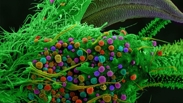 Секс долгоносиков, яйца бабочки и голова червя: 20 лучших снимков при помощи микроскопа