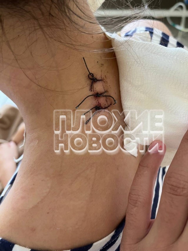"Если не умрешь, найду и добью"