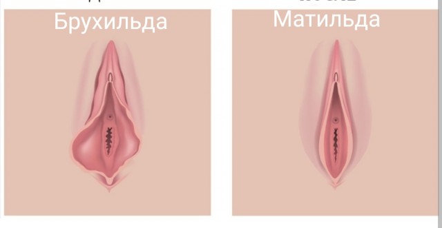 Девочки, верните молодость своей Матильде!
