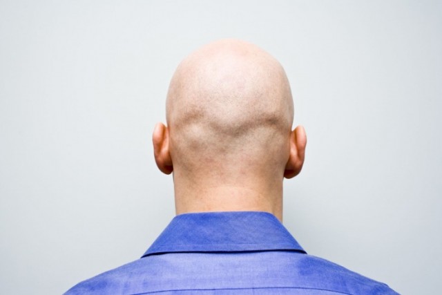 Россиянки любят лысых мужчин, — психологи