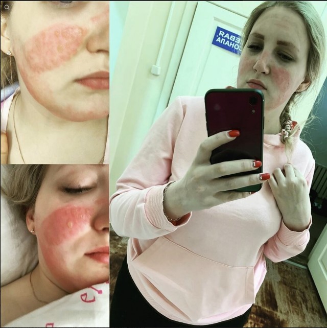 Жалующихся на условия и отсутствие СИЗ медиков запугивают уголовным преследованием