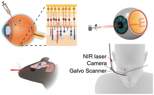 Инъекции золота в глаза могут стать будущим сохранения зрения