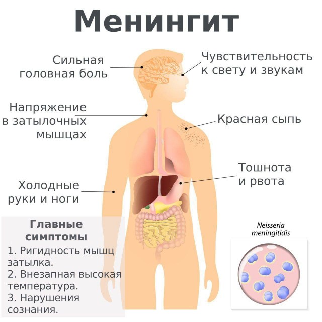 В России всплеск менингита — Москва стала лидером по числу заражений