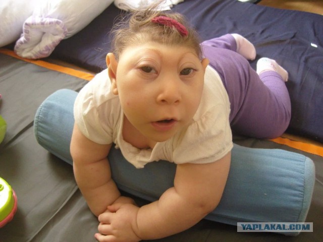 Эффект «заячьих губок»: результатами новой авторской методики поделилась косметолог-уродолог в сети