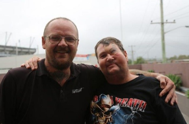 Тату вместо глаза, на месте укуса паука