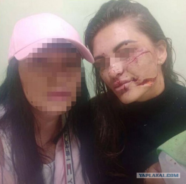 В Алтайском крае неадекват разбил стакан о лицо девушки за отказ познакомиться