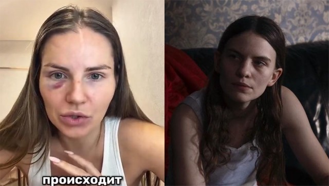 Даже после разбитого лица не поняла, что надо думать что говоришь