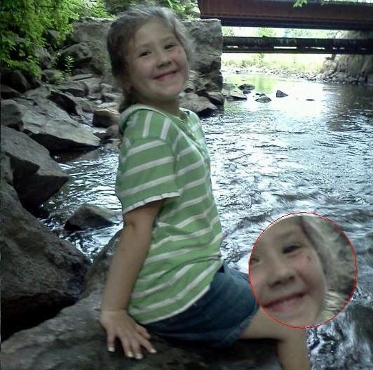 Слишком поздно заметил комара на щеке