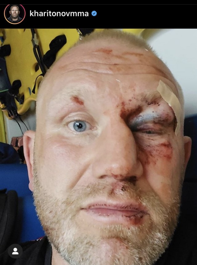 Бойцу UFC Яндиеву предъявили обвинение в нанесении травм Харитонову