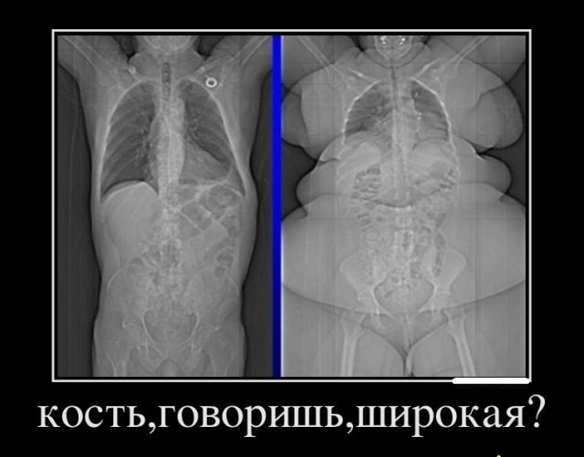Полные люди