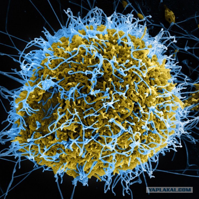 Чума XXI века: вирус Эбола.