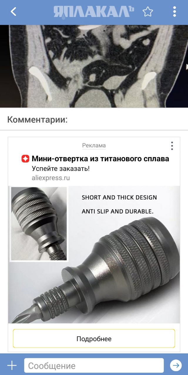 Великобританка едва не умерла во время МРТ из-за анальной пробки.