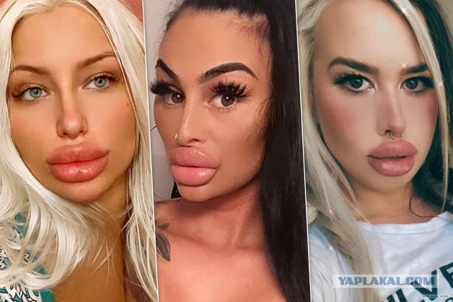 Накладные плечи: в Москве мужчины стали массово увеличивать мышцы в клиниках красоты