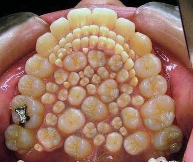 А у вас ровные зубы?