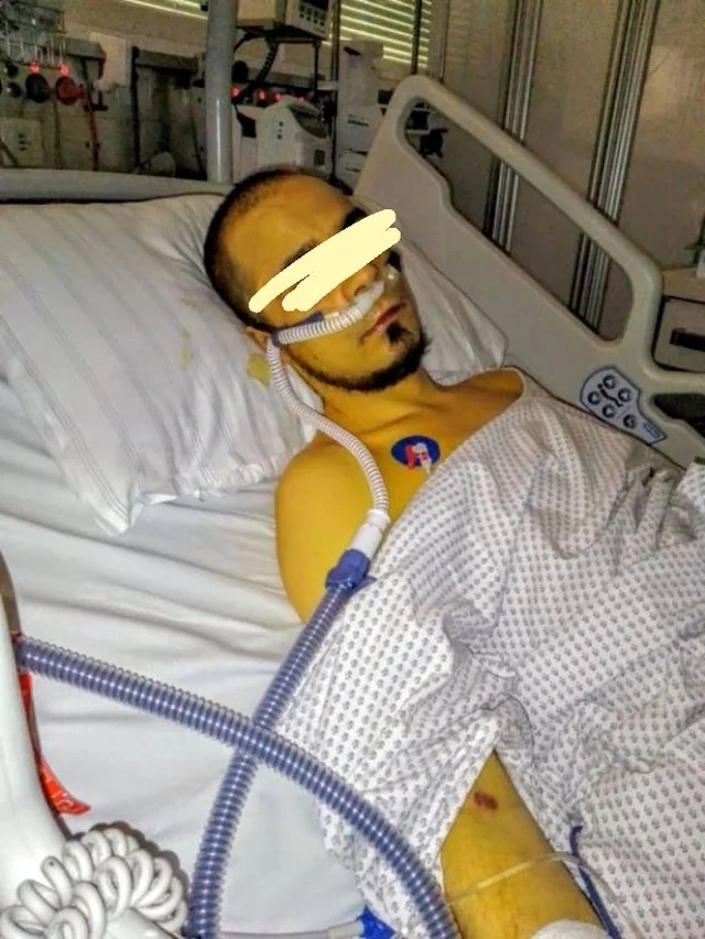 Лептоспироз - болезнь от домашнего любимца,которая сделает вас жёлтым как лимон и выжить после которой будет очень сложно