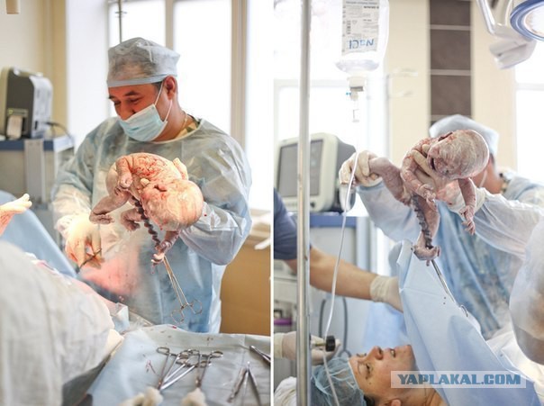 Так начинается жизнь