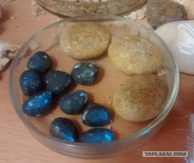 Камни в почках