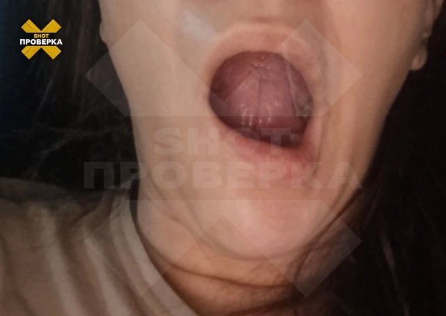 У женщины перекосило рот после коктейля «Монако»