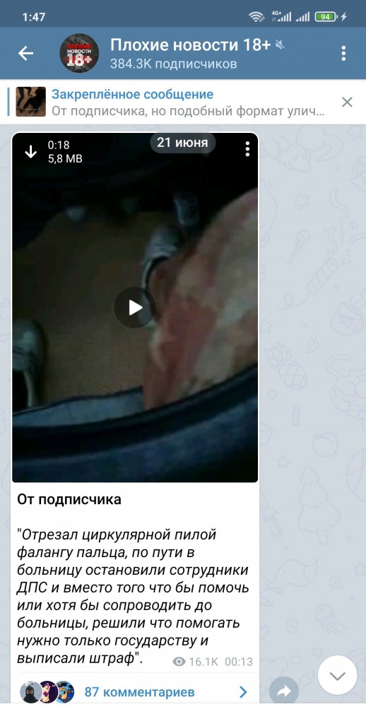 Отрезал циркулярной пилой фалангу пальца