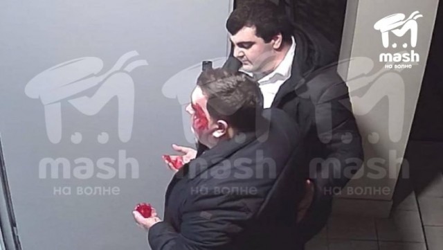 Замглавы ялтинского Следкома разбил подчинённому лицо на празднике в честь дня образования СК