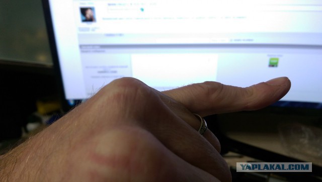 Когда идиотам делать нечего: люди делают себе вывих большого пальца и делятся результатами
