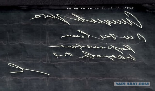 Результат ЭКГ