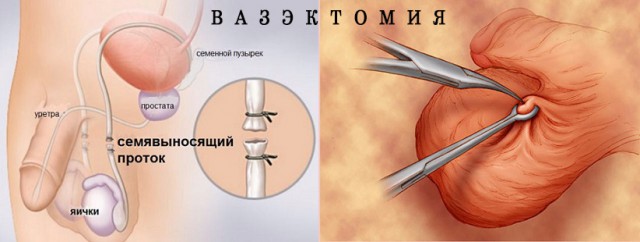 Ребенок не от мужа - ваше мнение