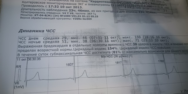 Мужики, берегите себя...