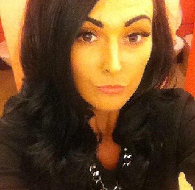 Пьяный мужик откусил девушке кусок щеки