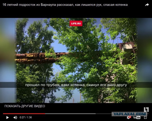 16 летний подросток из Барнаула рассказал, как лишился рук, спасая котенка