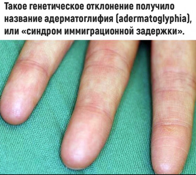 С миру по нитке на 2.02.21